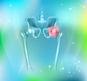 hip pain, abstract blue background. Hip arthritis