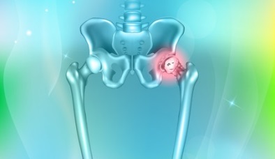 hip-pain-abstract-blue-background