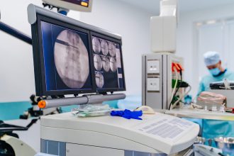 Modern equipment in operating room. Spine Surgery. Group of surgeons in operating room.